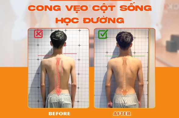 cong-veo-cot-song-hoc-duong-dung-chu-quan